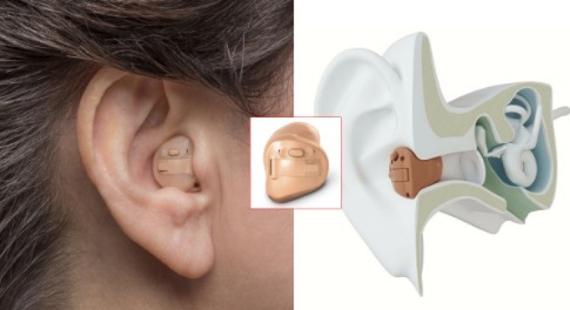 3D anatomical illustration showing placement of an ITC In-The-Canal hearing aid inside the ear canal for natural hearing performance and comfort.