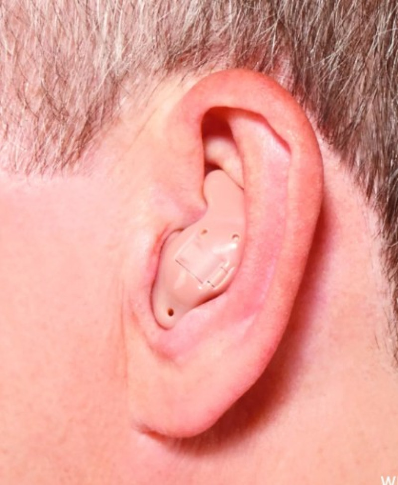 ITE hearing aid worn comfortably in the outer ear with custom fit design
