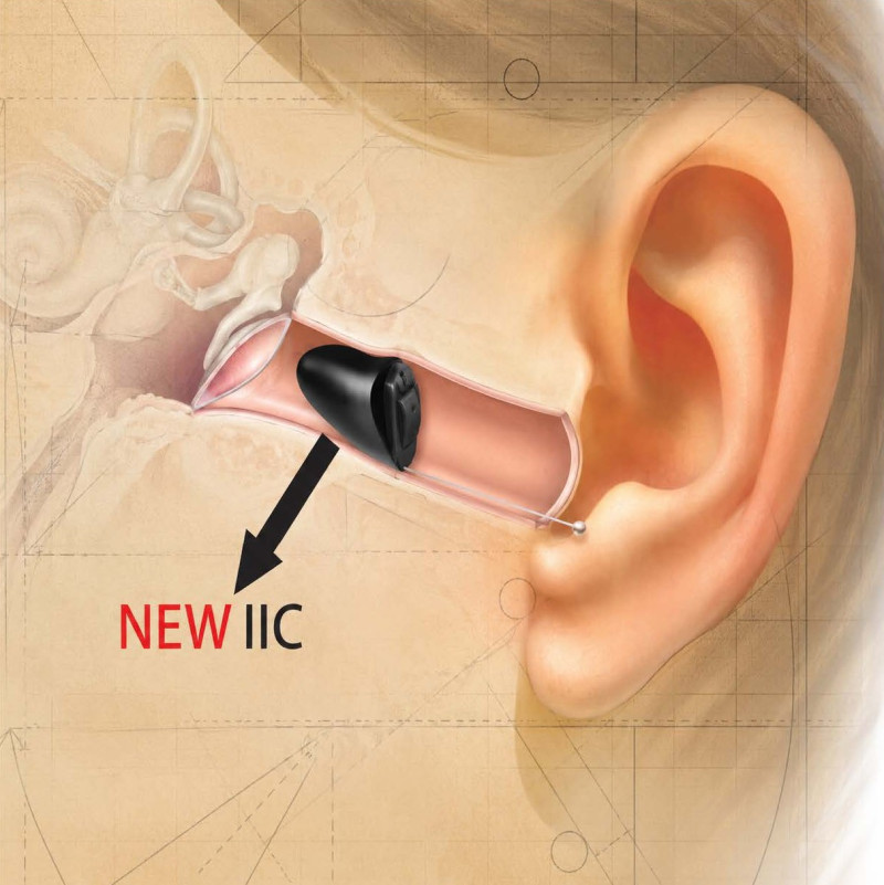 Deep insertion IIC hearing aid positioned inside the ear canal