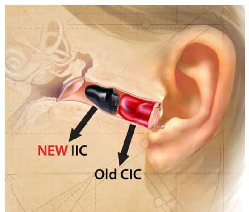 IIC hearing aid compared to CIC hearing aid showing deeper ear canal placement